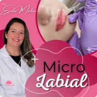 Imagem do curso Micro Labial - Érika Martini